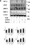 Fig.3.B showing Western Blotting from the publication: Inhibition of hypoxia inducible factor-1α attenuates abdominal aortic aneurysm progression through the down-regulation of matrix metalloproteinases.