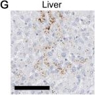 Fig.1.G showing Immunohistochemistry-paraffin in a Homo sapiens (Human) sample from the publication: Evaluating real-time immunohistochemistry on multiple tissue samples, multiple targets and multiple antibody labeling methods.