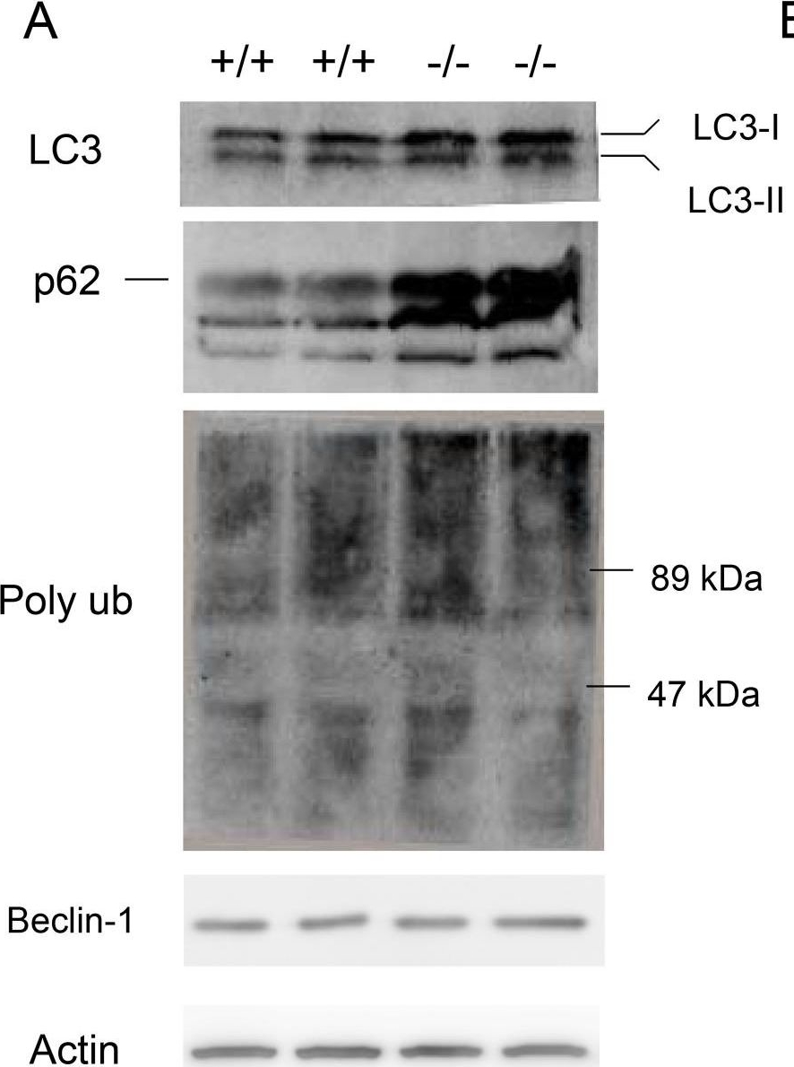 Cathepsin E deficiency impairs autophagic proteolysis in macrophages.