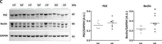 Fig.6.C showing Western Blotting from the publication: Increased clusterin levels after myocardial infarction is due to a defect in protein degradation systems activity.