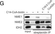Fig.1.G showing Western Blotting in a Mus musculus (House mouse) sample from the publication: Long-chain fatty acyl coenzyme A inhibits NME1/2 and regulates cancer metastasis.