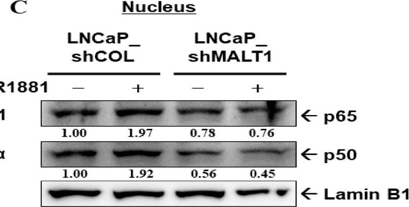 Fig.3.C showing Western Blotting in a Homo sapiens (Human) sample from the publication: Androgen Receptor Upregulates Mucosa-Associated Lymphoid Tissue 1 to Induce NF-κB Activity via Androgen-Dependent and -Independent Pathways in Prostate Carcinoma Cells.