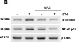 Fig.2.B showing Western Blotting in a Homo sapiens (Human) sample from the publication: Targeting the Endothelin-1 pathway to reduce invasion and chemoresistance in gallbladder cancer cells.