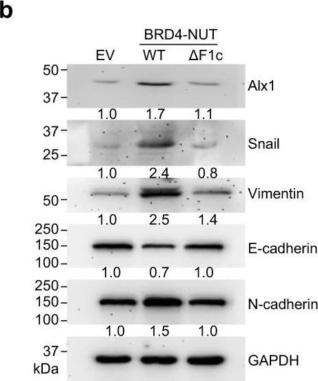 Fig.7.B showing Western Blotting in a Homo sapiens (Human) sample from the publication: Structural mechanism of BRD4-NUT and p300 bipartite interaction in propagating aberrant gene transcription in chromatin in NUT carcinoma.