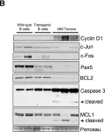 Fig.6.B showing Western Blotting from the publication: The differentiation and stress response factor XBP-1 drives multiple myeloma pathogenesis.