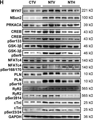 Fig.9.H showing Western Blotting from the publication: Nsun2 controls cardiac homeostasis and hypertrophic response by regulating PRKACA expression.