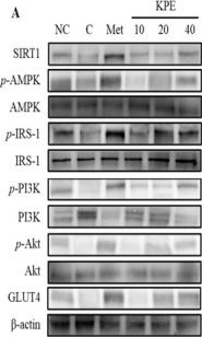 Fig.6.A showing Western Blotting in a Mus musculus (House mouse) sample from the publication: Kaempferia parviflora Rhizome Extract Improves Skeletal Muscle Glucose Homeostasis by Upregulating the GLUT4 Signaling Pathway In Vitro and In Vivo.