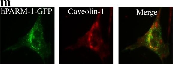Fig.4.M showing Immunocytochemistry-immunofluorescence in a Mus musculus (House mouse) sample from the publication: Characterization and identification of PARM-1 as a new potential oncogene.