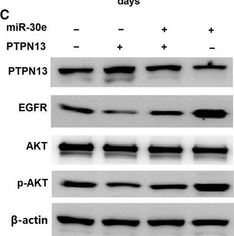 Fig.5.C showing Western Blotting in a Homo sapiens (Human) sample from the publication: MicroRNA-30e-5p promotes cell growth by targeting PTPN13 and indicates poor survival and recurrence in lung adenocarcinoma.