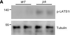 Fig.5.A showing Western Blotting in a Mus musculus (House mouse) sample from the publication: SCF-SKP2 E3 ubiquitin ligase links mTORC1/ER stress/ISR with YAP activation in murine renal cystogenesis.
