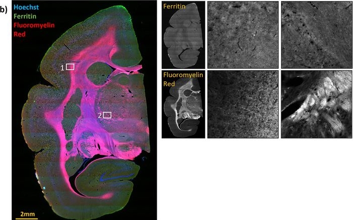 Fig.2.B showing Immunohistochemistry-immunofluorescence from the publication: Multiplex Immunofluorescent Batch Labeling of Marmoset Brain Sections.