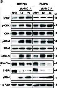 Fig.6.B showing Western Blotting in a Homo sapiens (Human) sample from the publication: ARID1A Governs Genomic Stability and Proliferation in SCLC via c-MYC/PARP1 Suppression Driving Vulnerability to BET Inhibitors.