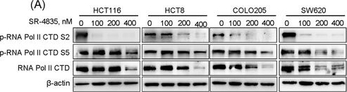 Fig.5.A showing Western Blotting from the publication: CDK12 orchestrates super-enhancer-associated CCDC137 transcription to direct hepatic metastasis in colorectal cancer.