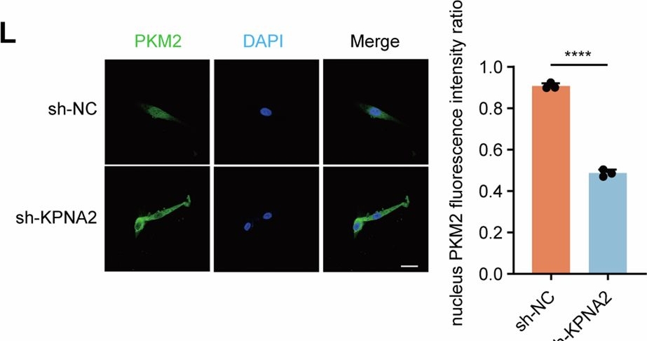 Fig.4.L showing Immunocytochemistry-immunofluorescence from the publication: Glycolysis reprogramming in CAFs promotes oxaliplatin resistance in pancreatic cancer through circABCC4 mediated PKM2 nuclear translocation.
