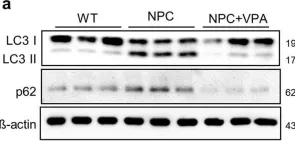 Fig.7.A showing Western Blotting from the publication: Human iNSC-derived brain organoid model of lysosomal storage disorder in Niemann-Pick disease type C.