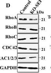 Fig.4.D showing Western Blotting from the publication: Septin11 promotes hepatocellular carcinoma cell motility by activating RhoA to regulate cytoskeleton and cell adhesion.