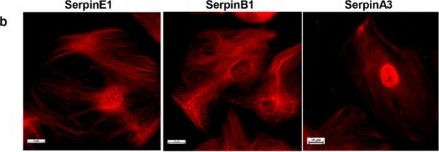 Fig.3.B showing Immunocytochemistry-immunofluorescence from the publication: Podocytes as novel sources of neutrophil serine proteases: expression and regulation by inflammatory molecular patterns.