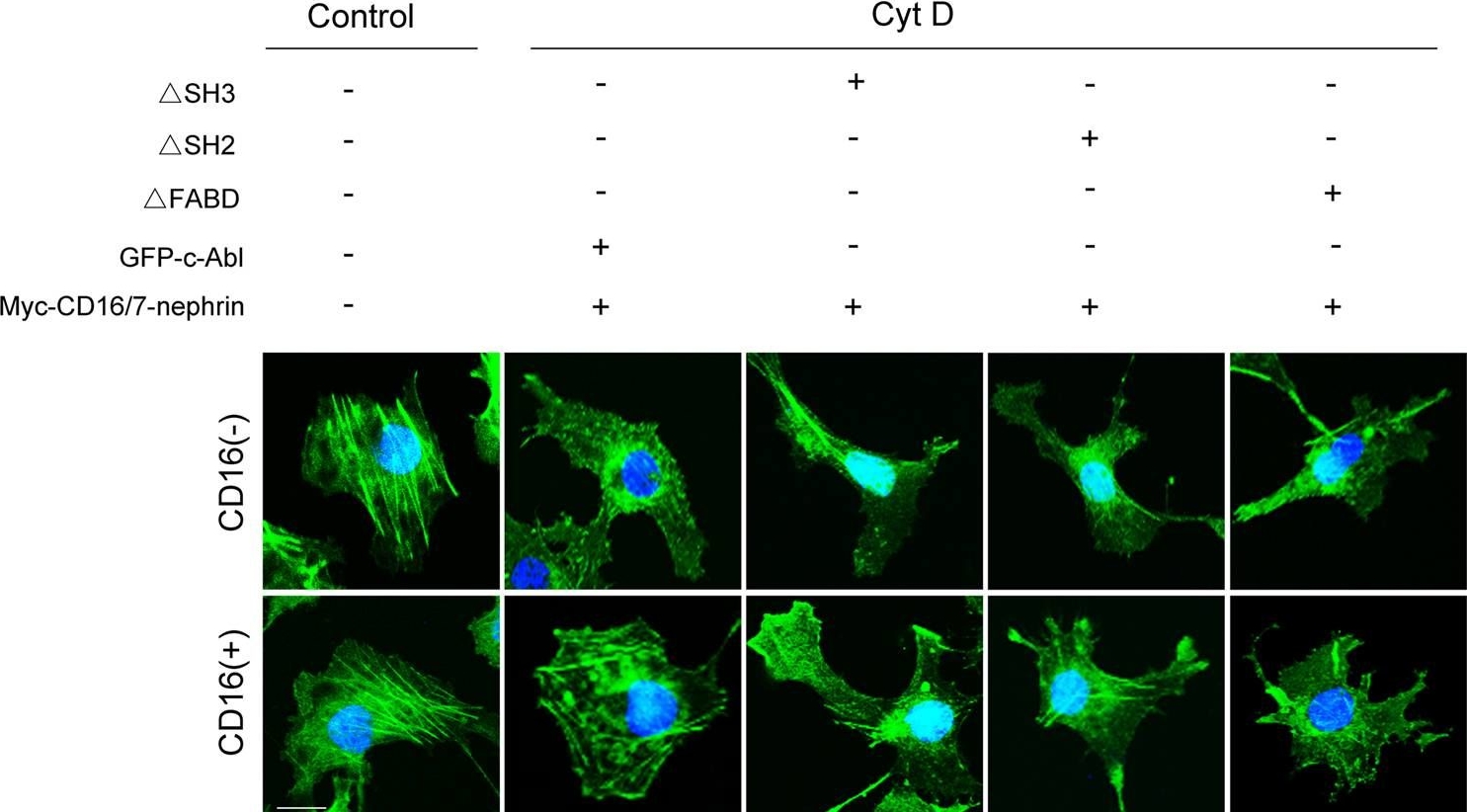 Role of c-Abl and nephrin in podocyte cytoskeletal remodeling induced by angiotensin II.