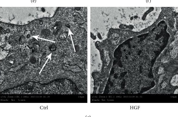 Fig.1.E from the publication: Autophagy Is Required for Hepatic Differentiation of Hepatic Progenitor Cells via Wnt Signaling Pathway.