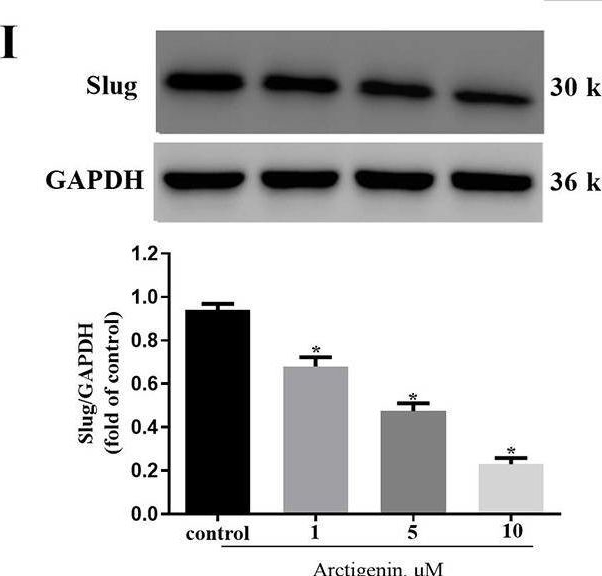 Fig.6.I showing Western Blotting in a Homo sapiens (Human) sample from the publication: RETRACTED: Arctigenin inhibits the progression of colorectal cancer through epithelial-mesenchymal transition via PI3K/Akt/mTOR signaling pathway.
