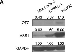 Fig.4.A showing Western Blotting in a Homo sapiens (Human) sample from the publication: PEG-BCT-100 and Canavanine Synergistically Induce Apoptosis in Arginine Biosynthetic Enzyme-Deficient Pancreatic Cancer.