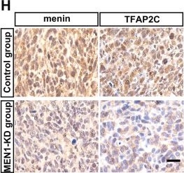Fig.4.H showing Immunohistochemistry in a Mus musculus (House mouse) sample from the publication: Menin facilitates the cell proliferation of bladder cancer via modulating the TFAP2C/β-catenin axis.
