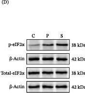 Fig.5.D showing Western Blotting from the publication: Identification of Integrated Stress Response-Related Biomarkers in Sepsis-Induced Acute Respiratory Distress Syndrome.
