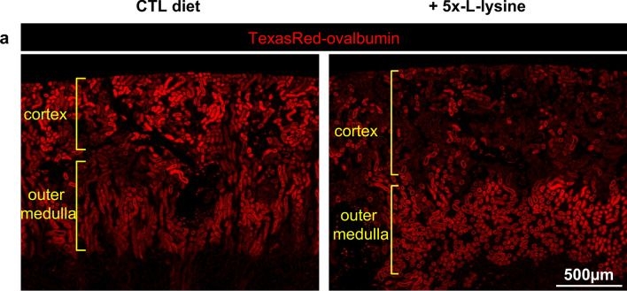 Fig.4.A showing Immunohistochemistry-immunofluorescence from the publication: Dietary supplementation of cystinotic mice by lysine inhibits the megalin pathway and decreases kidney cystine content.