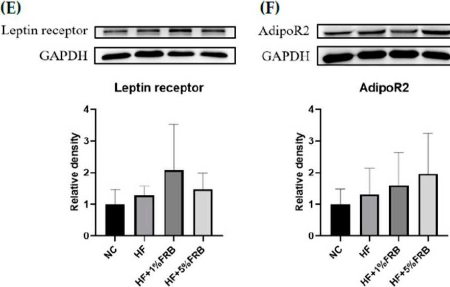 Fig.5.E showing Western Blotting in a Rattus norvegicus (Rat) sample from the publication: Effects of the Water Extract of Fermented Rice Bran on Liver Damage and Intestinal Injury in Aged Rats with High-Fat Diet Feeding.