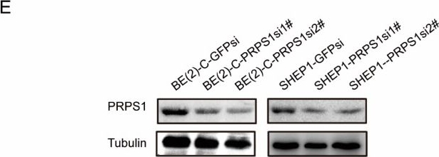 Fig.2.E showing Western Blotting from the publication: Down-Regulation of Phosphoribosyl Pyrophosphate Synthetase 1 Inhibits Neuroblastoma Cell Proliferation.