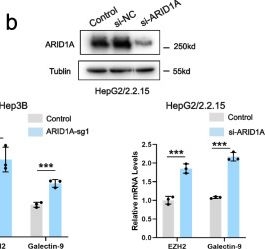 Fig.5.B showing Western Blotting in a Homo sapiens (Human) sample from the publication: ARID1A deficiency promotes progression and potentiates therapeutic antitumour immunity in hepatitis B virus-related hepatocellular carcinoma.