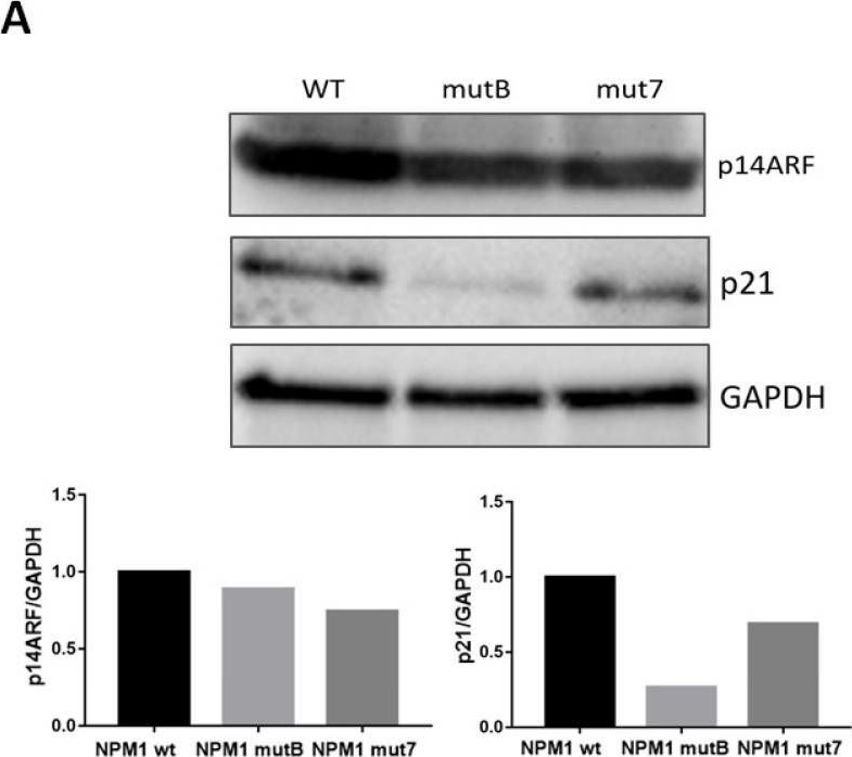 Fig.3.A showing Western Blotting in a Homo sapiens (Human) sample from the publication: NPM1 Mutational Status Underlines Different Biological Features in Pediatric AML.