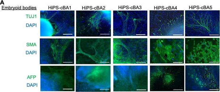 Fig.2.A showing Immunocytochemistry-immunofluorescence in a Homo sapiens (Human) sample from the publication: Generation of human induced pluripotent stem cell lines derived from patients of cystic biliary atresia.