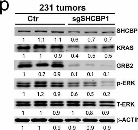 Fig.5.P showing Western Blotting in a Mus musculus (House mouse) sample from the publication: Oncogenic activation of SMYD3-SHCBP1 promotes breast cancer development and is coupled with resistance to immune therapy.