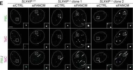 Fig.5.E showing Immunocytochemistry-immunofluorescence from the publication: SLX4IP limits replication stress globally and at ALT telomeres.