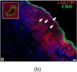 Fig.5.B showing Immunohistochemistry in a Rattus norvegicus (Rat) sample from the publication: C-Kit Cardiac Progenitor Cell Based Cell Sheet Improves Vascularization and Attenuates Cardiac Remodeling following Myocardial Infarction in Rats.