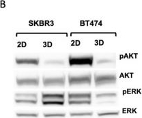 Fig.4.B showing Western Blotting in a Homo sapiens (Human) sample from the publication: 3D Breast Cancer Spheroids Reveal Architecture-Dependent HER2 Expression and Signaling.