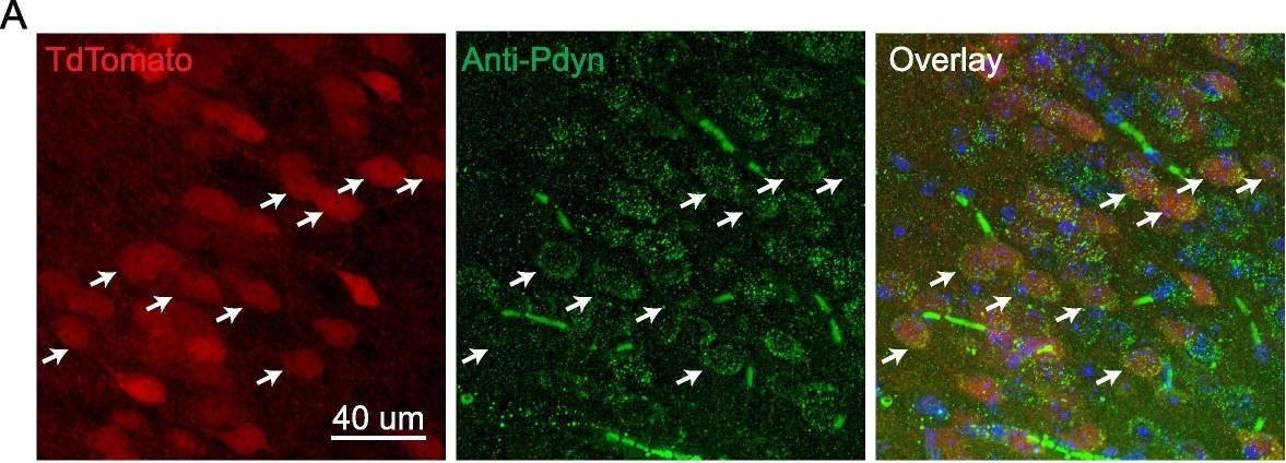 Fig.2.A showing Immunohistochemistry-immunofluorescence in a Mus musculus (House mouse) sample from the publication: Mouse models of surgical and neuropathic pain produce distinct functional alterations to prodynorphin expressing neurons in the prelimbic cortex.