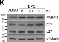 Fig.1.K showing Western Blotting in a Mus musculus (House mouse) sample from the publication: Defective neurogenesis and schizophrenia-like behavior in PARP-1-deficient mice.