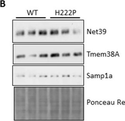 Fig.3.B showing Western Blotting from the publication: Lamin A/C Assembly Defects in LMNA-Congenital Muscular Dystrophy Is Responsible for the Increased Severity of the Disease Compared with Emery-Dreifuss Muscular Dystrophy.