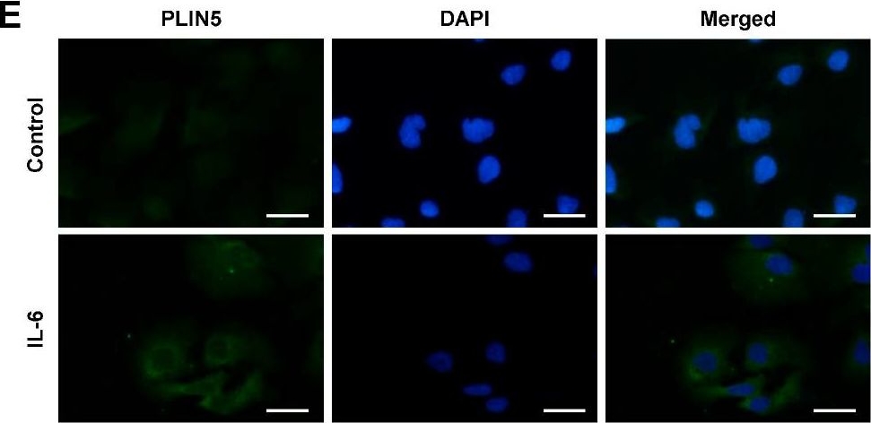 Lipid-Independent Regulation of PLIN5 via IL-6 through the JAK/STAT3 Axis in Hep3B Cells.