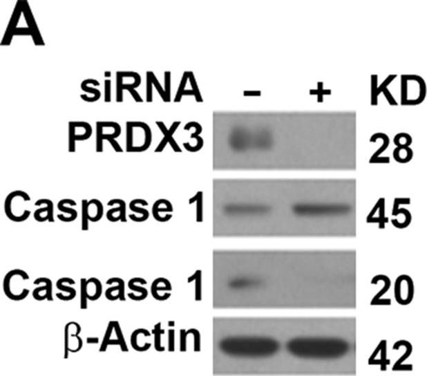 Fig.5.A showing Western Blotting in a Homo sapiens (Human) sample from the publication: Mitochondrion-associated protein peroxiredoxin 3 promotes benign prostatic hyperplasia through autophagy suppression and pyroptosis activation.
