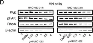 Fig.6.D showing Western Blotting in a Homo sapiens (Human) sample from the publication: MERTK as a novel therapeutic target in head and neck cancer.