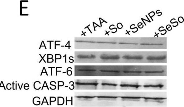 Fig.4.E showing Western Blotting from the publication: Therapeutic Effect of Selenium Nanoparticles, Sorafenib, and Selenium-Sorafenib Nanocomplex in the Lungs and Kidneys of Mice with TAA-Induced HCC.