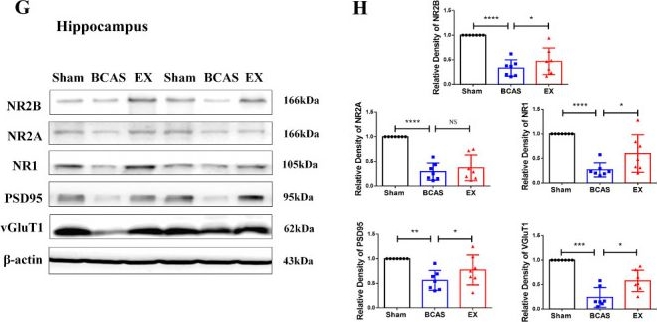 Fig.3.G showing Western Blotting in a Mus musculus (House mouse) sample from the publication: Aerobic Exercise Improves Cognitive Recovery in Mice with Chronic Cerebral Hypoperfusion by Modulating the Annexin-A1-MAPK Axis and Astrocyte Polarization.
