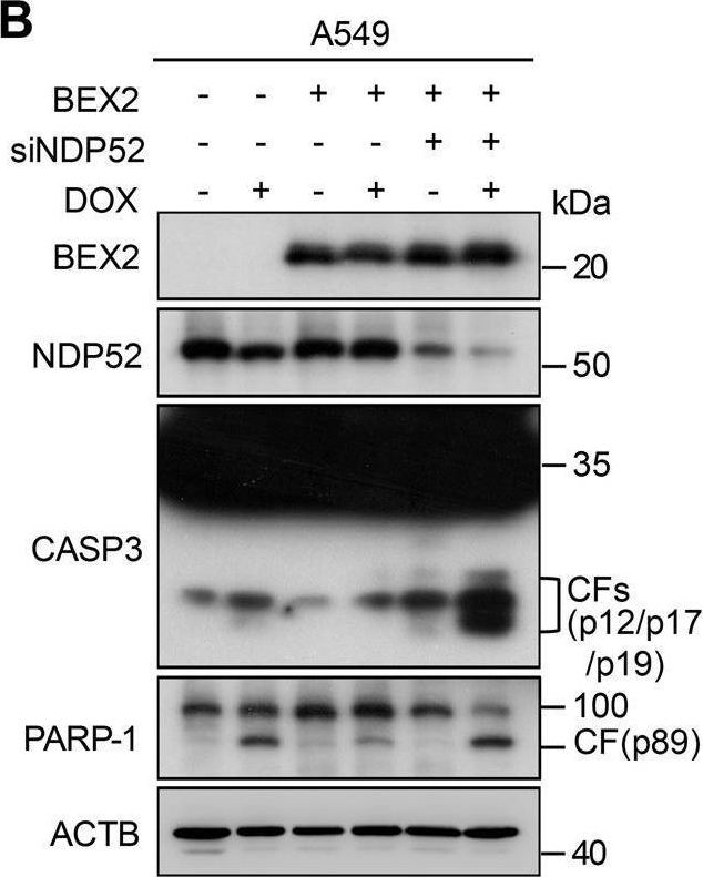 Fig.5.B showing Western Blotting in a Homo sapiens (Human) sample from the publication: Crotonylated BEX2 interacts with NDP52 and enhances mitophagy to modulate chemotherapeutic agent-induced apoptosis in non-small-cell lung cancer cells.