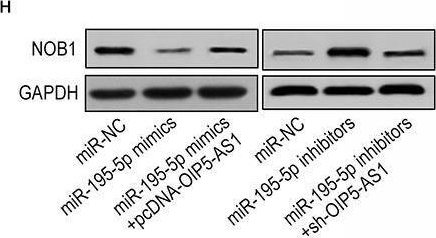 Fig.4.H showing Western Blotting from the publication: LncRNA OIP5-AS1 Promotes the Proliferation of Hemangioma Vascular Endothelial Cells via Regulating miR-195-5p/NOB1 Axis.
