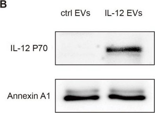 Fig.2.B showing Western Blotting from the publication: Improving CAR-T cell function through a targeted cytokine delivery system utilizing car target-modified extracellular vesicles.