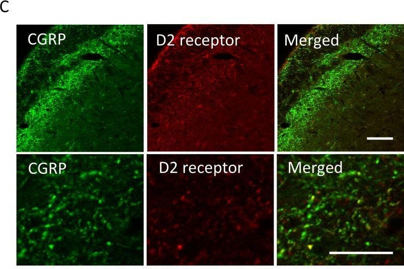 Fig.6.C showing Immunohistochemistry-immunofluorescence in a Rattus norvegicus (Rat) sample from the publication: Suppression of mechanical hypersensitivity and change in the expression of the dopamine D2 receptor by administration of anti-CGRP antibody into the trigeminal ganglion in trigeminal neuropathic pain model rats.