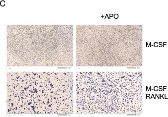 Fig.6.C showing Immunohistochemistry from the publication: Disrupted bone microenvironment and immune recovery following total body irradiation in a murine model.